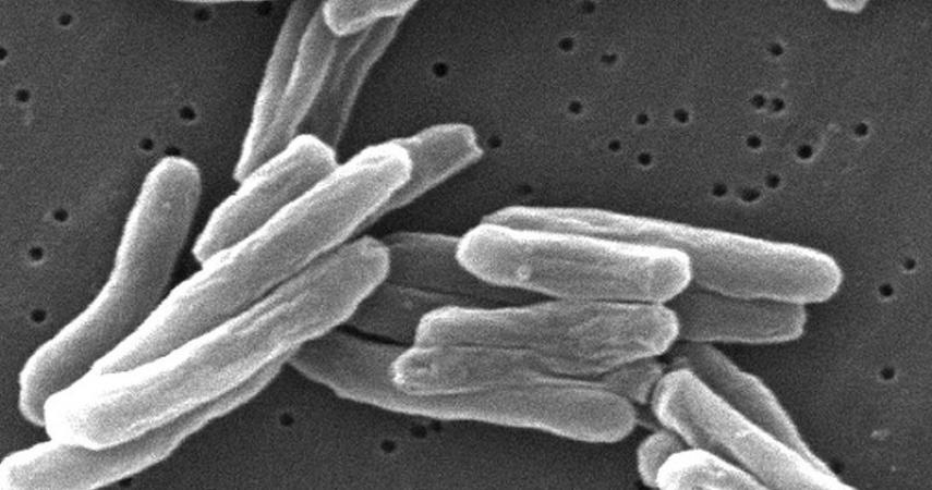 Tuberculosis- Imagen microscópica