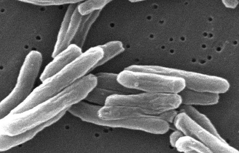 Tuberculosis- Imagen microscópica