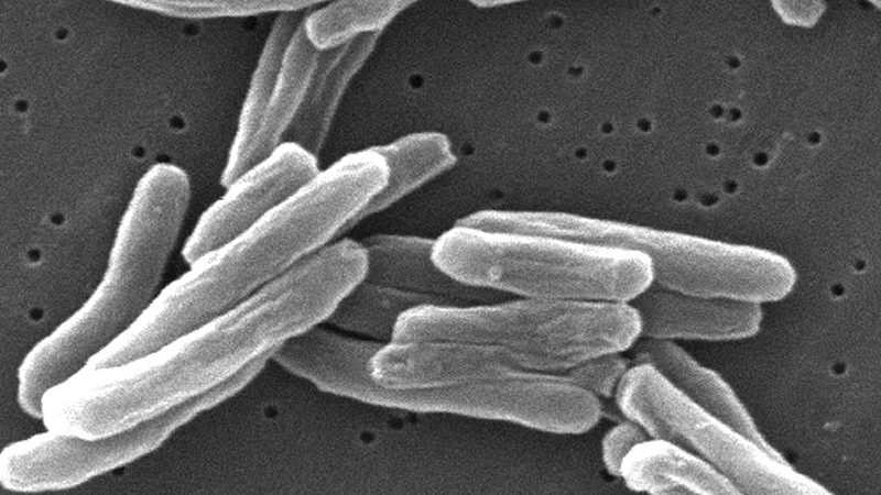 Tuberculosis- Imagen microscópica