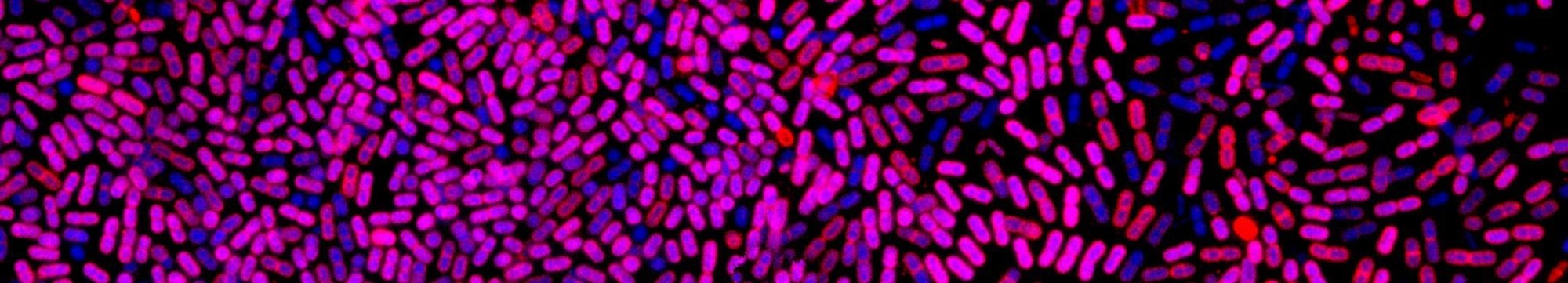 Bacterias ao microscopio con tinción gram (púrpura e azul)