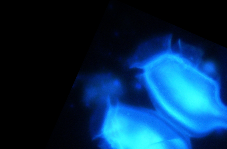 Citometría de fluxo.