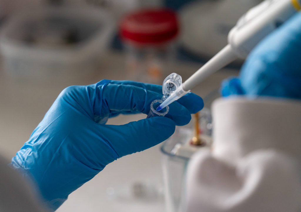 Mans botando mostra nun eppendorf