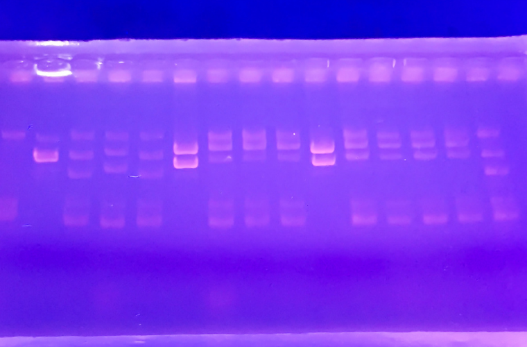Xel de electroforese baixo luz ultravioleta.