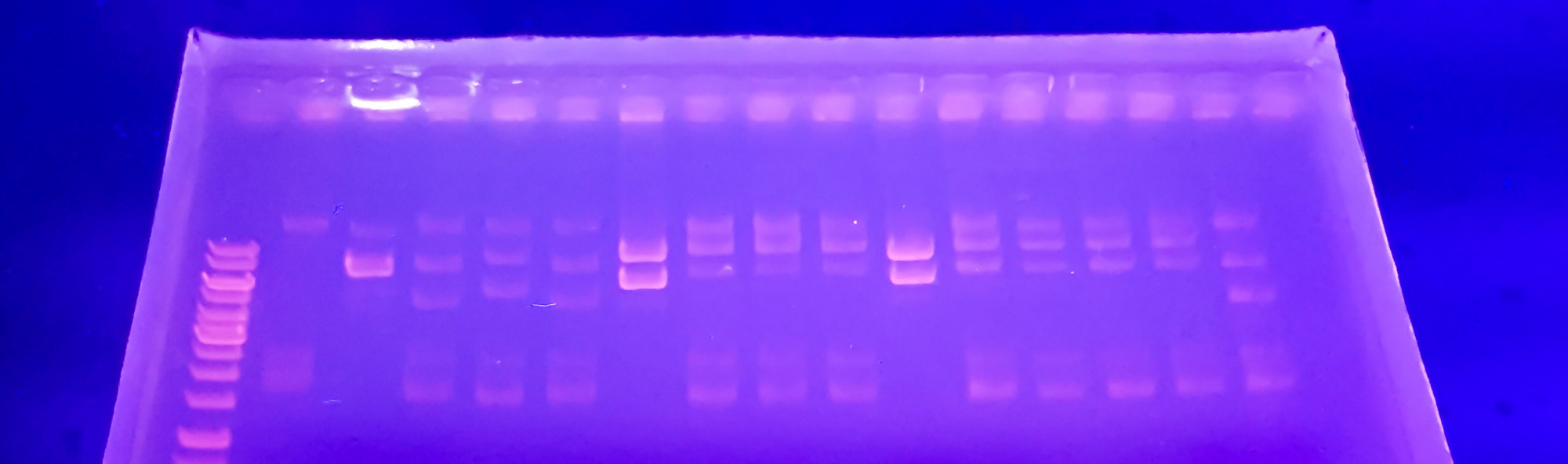 Xel de electroforese