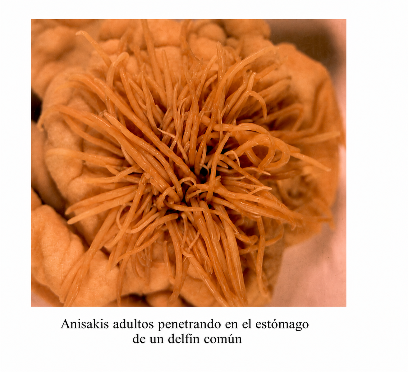 Imagen Noticia Anisakis